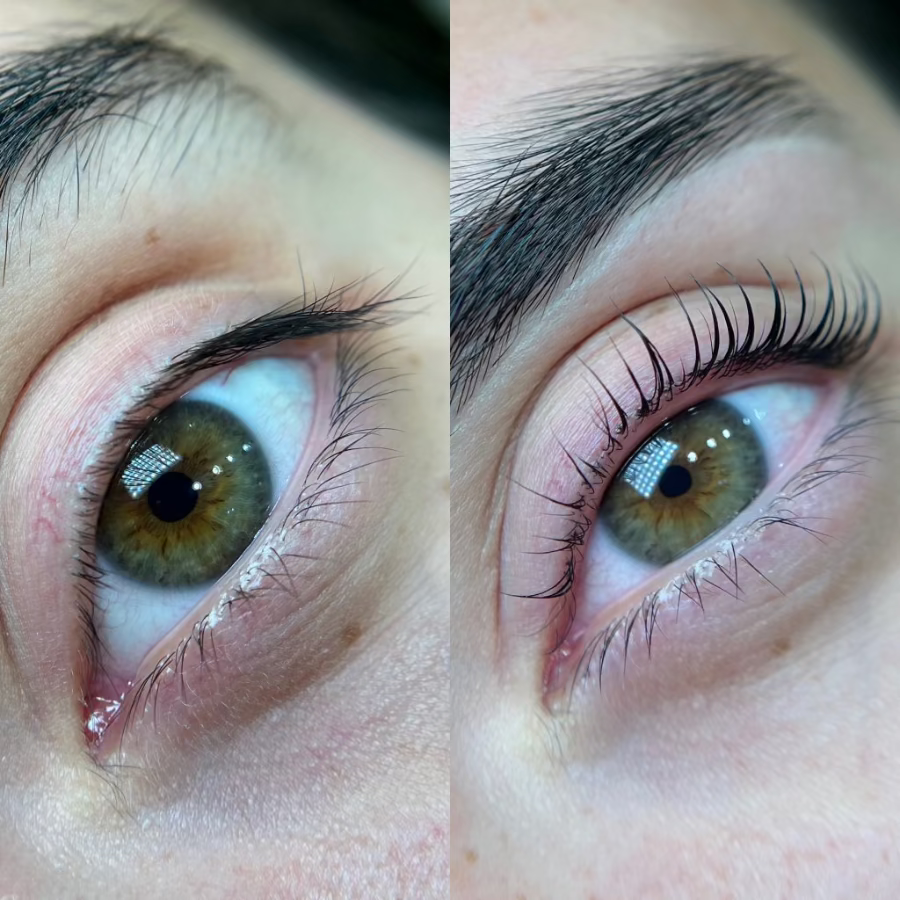 Close-up of a person's eye with and without eyelashes.