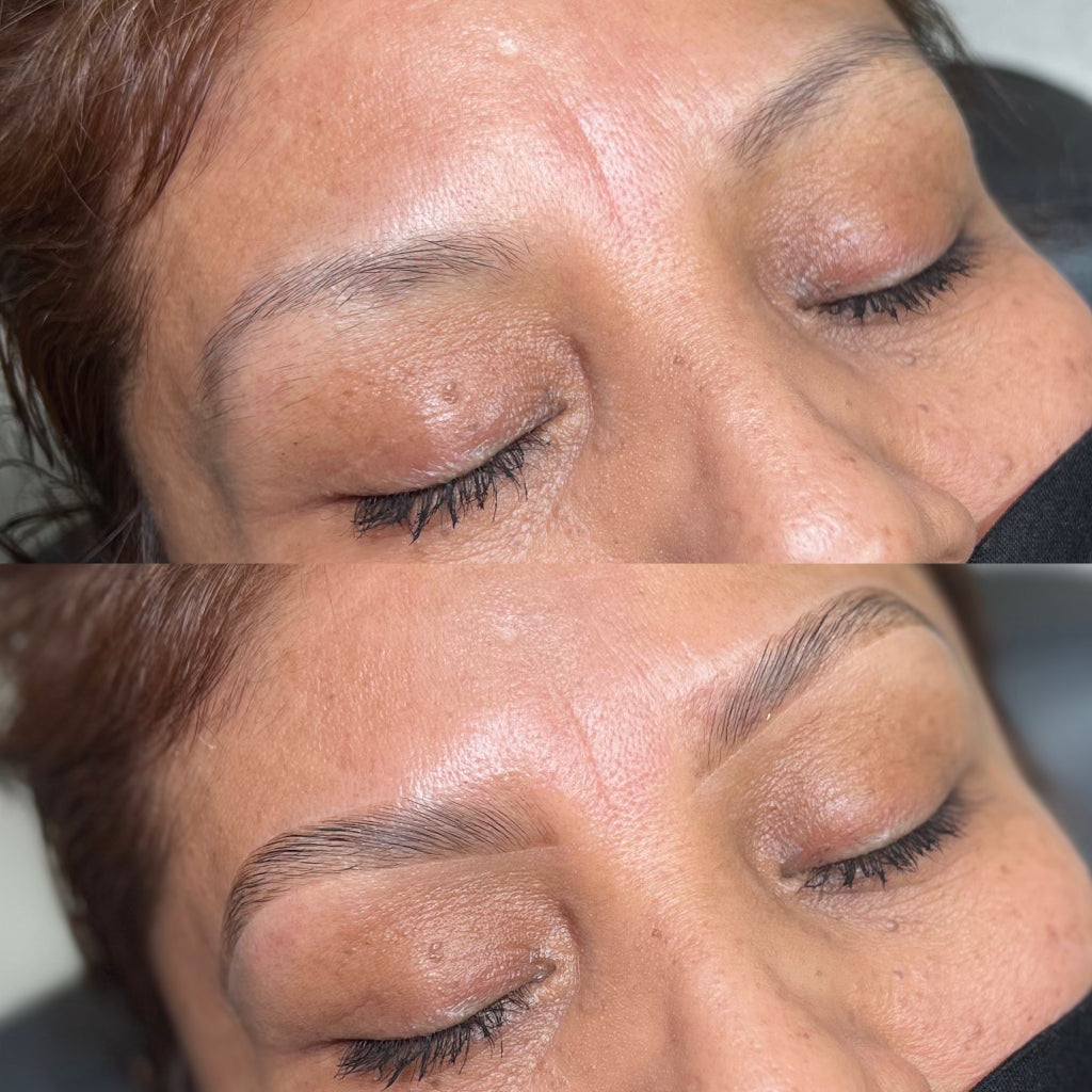 Before and after comparison of a woman's eye area with and without treatment.