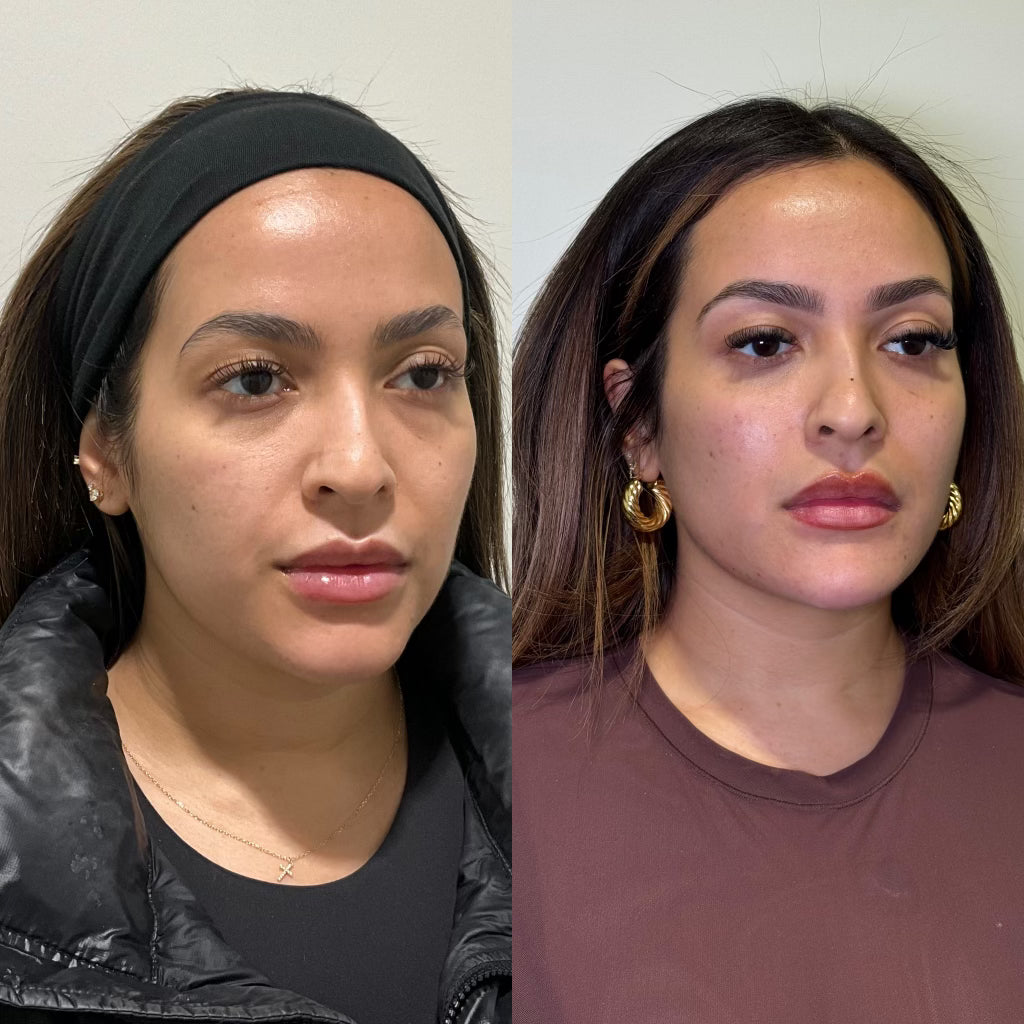 Side-by-side comparison of a woman with and without makeup against a plain background