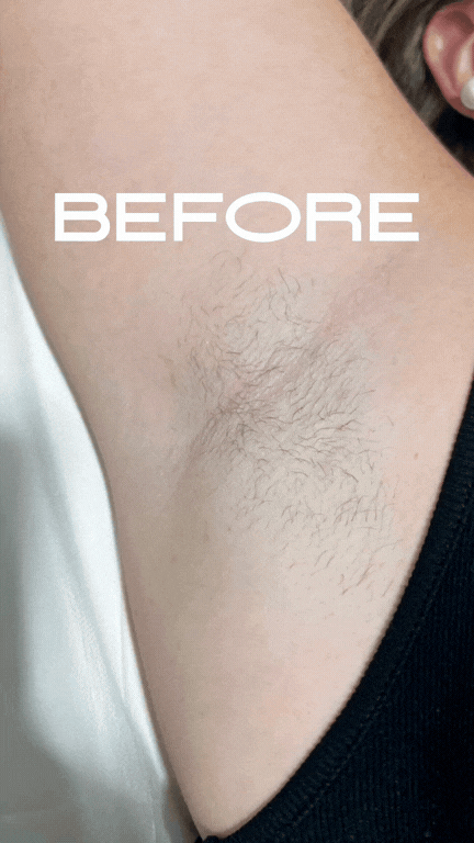 Video of a woman's underarm being waxed